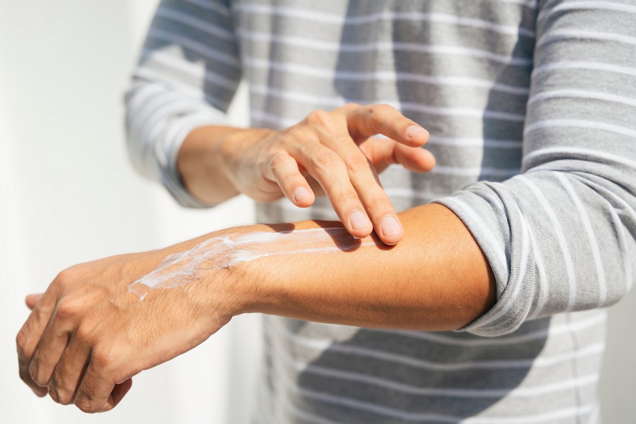 Hand of a man applies cream on his arm