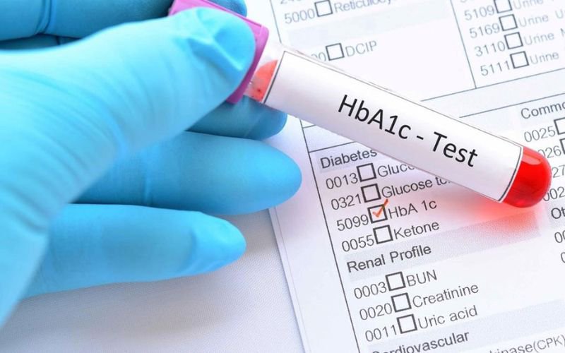 có thể mua bảo hiểm nhân thọ nếu chỉ số đường huyết ở mức chấp nhận được