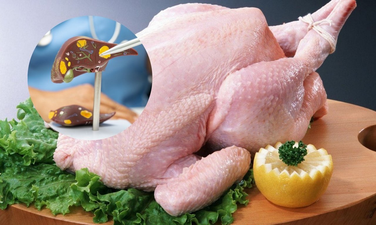 Banner - WISE - benh-xo-gan-co-an-duoc-thit-ga-khong