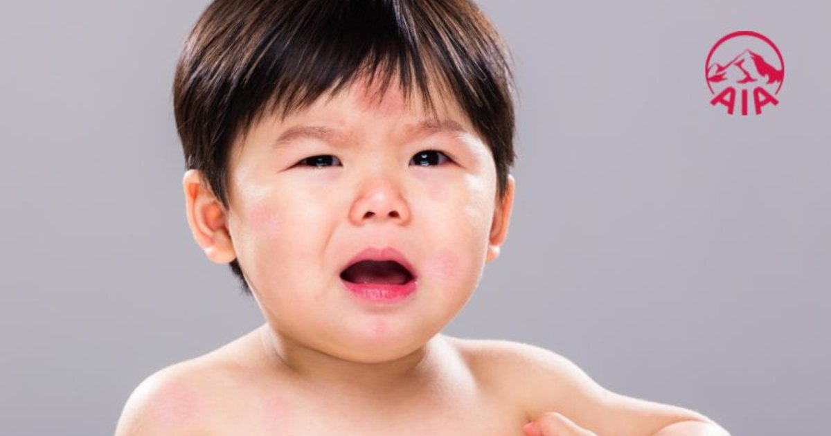 Nổi mẩn đỏ cảnh báo nhiều căn bệnh ngoài da