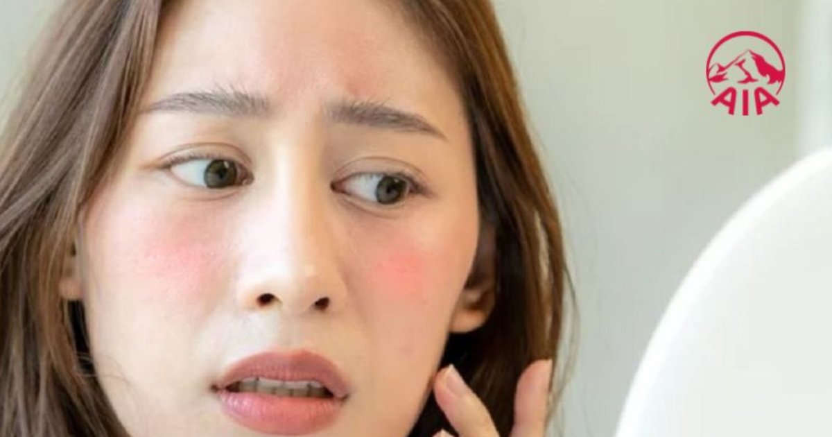 Đa số mọi người đều có khả năng bị mẩn đỏ da
