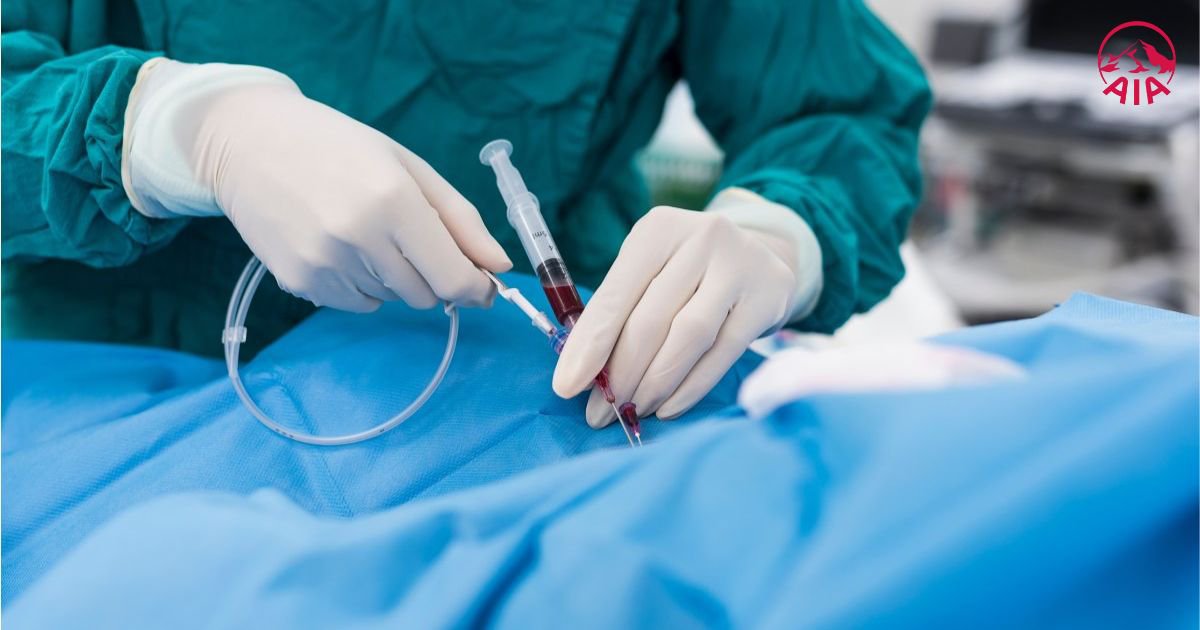  Bảo hiểm sẽ chi trả một mức chi phí nhất định cho người bệnh đặt stent mạch vành