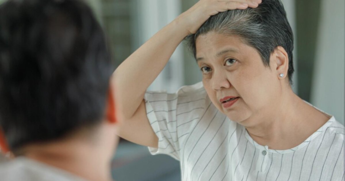Cải thiện tình trạng tóc bạc với hà thủ ô.