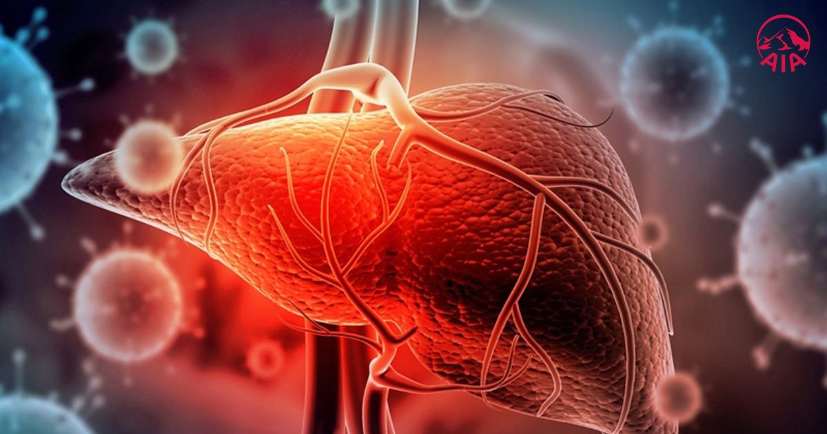 Giải đáp thắc mắc men gan cao có nguy hiểm không