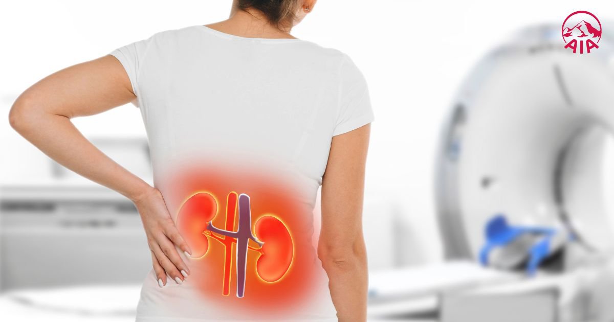 Sỏi thận dẫn đến đau đớn và các biến chứng nguy hiểm
