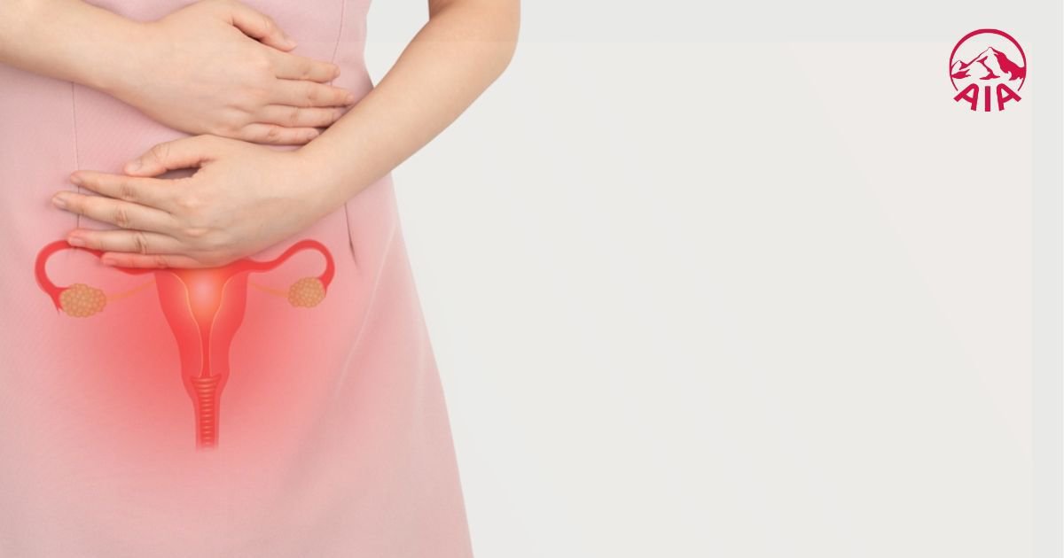 Rối loạn kinh nguyệt khiến chu kỳ kinh không còn diễn ra bình thường