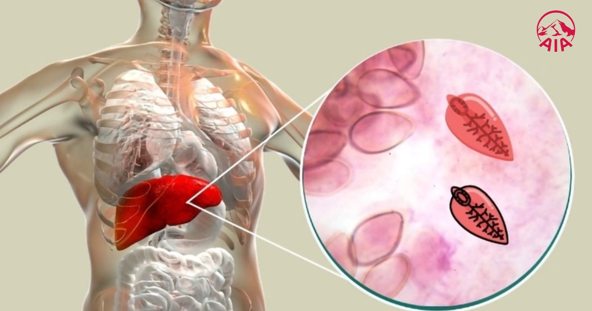 Sán lá gan có hình dạng dẹt giống chiếc lá