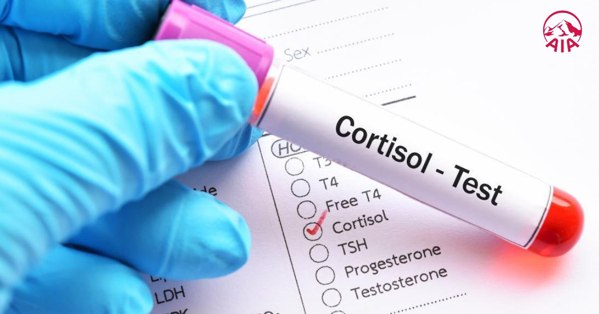 Xét nghiệm cortisol để xác định chỉ số sản xuất hormone của tuyến thượng thận