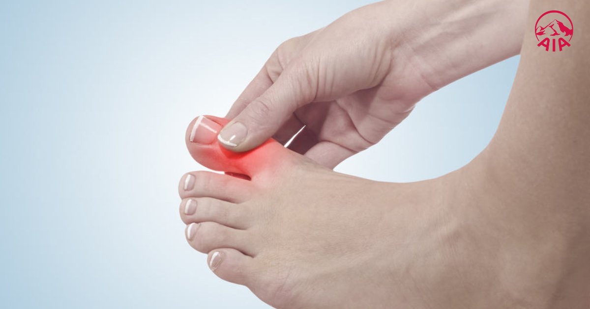 Purin trong bông cải xanh làm tăng mức axit uric trong máu