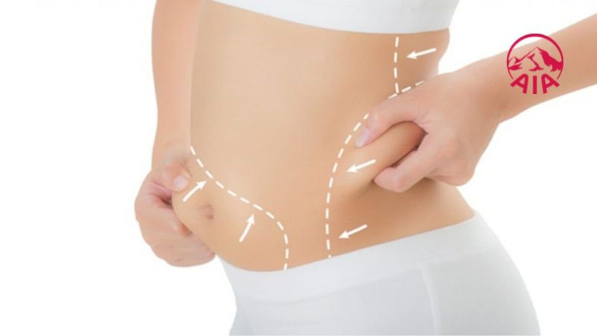 Người có cơ địa khó giảm cân dễ tăng cân hơn người bình thường