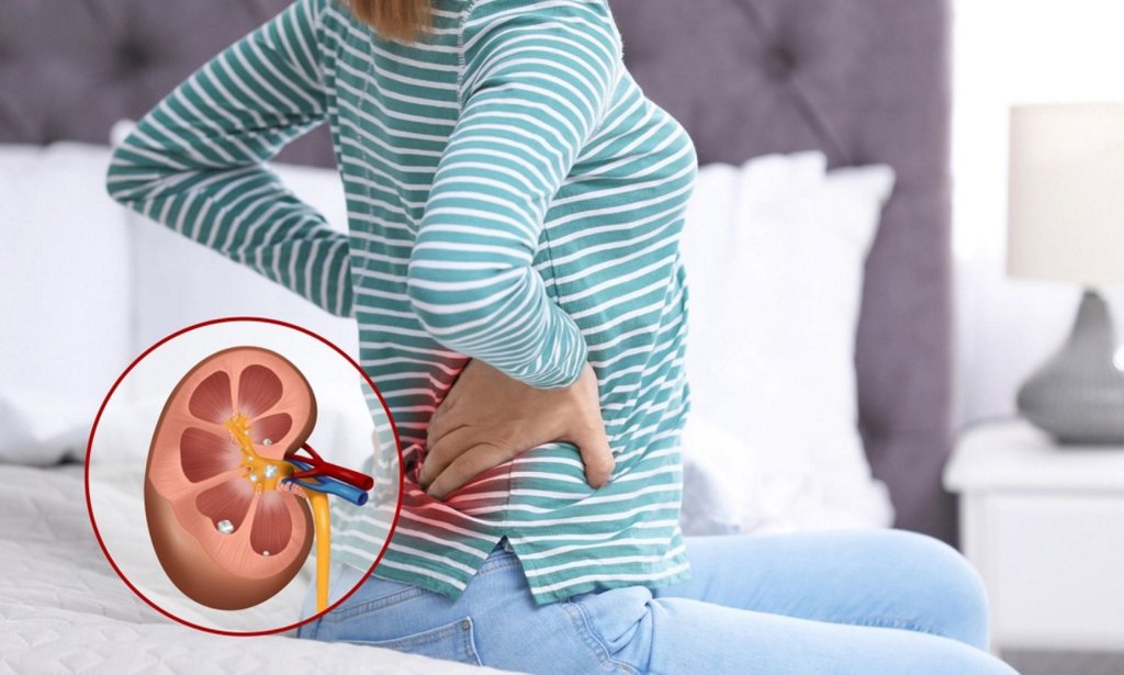 Người bị sỏi thận kiêng ăn gì và nên ăn gì để bệnh không trở nên nghiêm  trọng? | bị sỏi thận kiêng ăn gì | AIA Vietnam