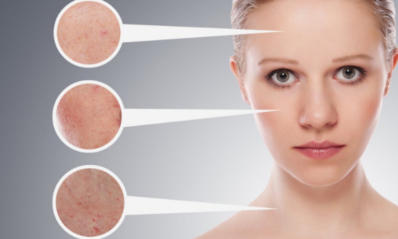 banner dấu hiệu rối loạn nội tiết tố