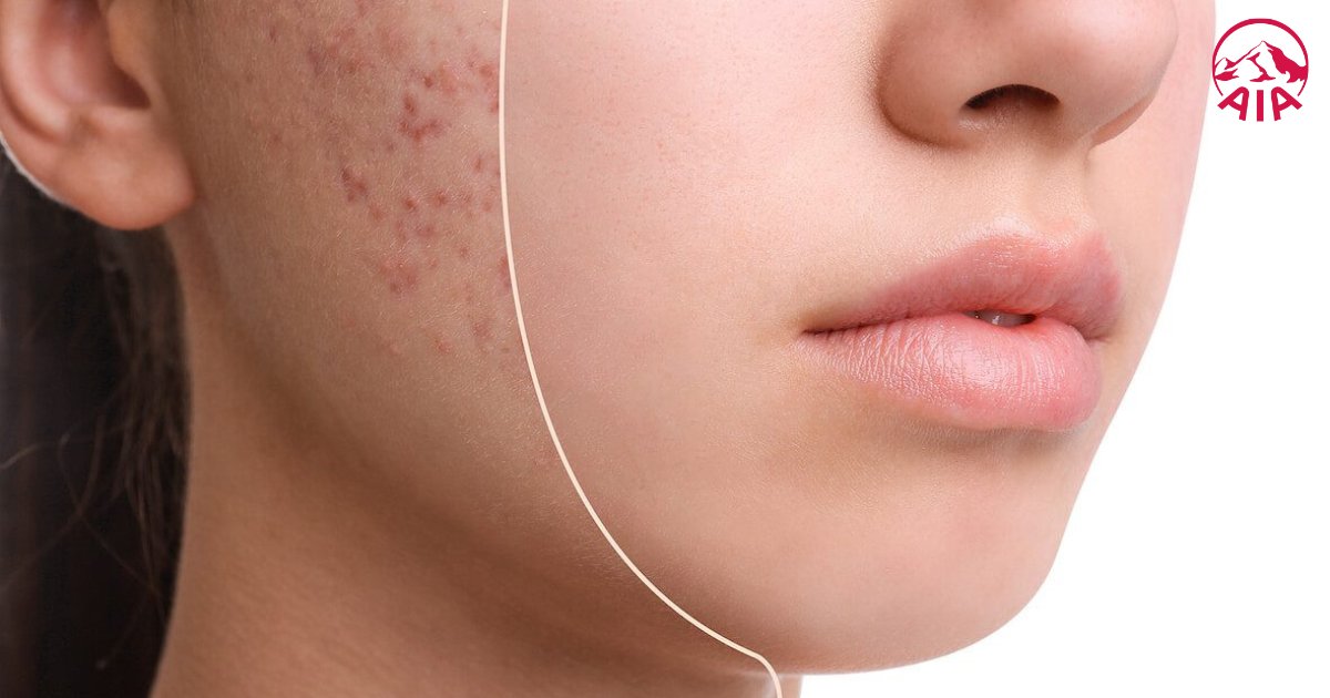 Tinh dầu hoa anh thảo có tác dụng gì? 