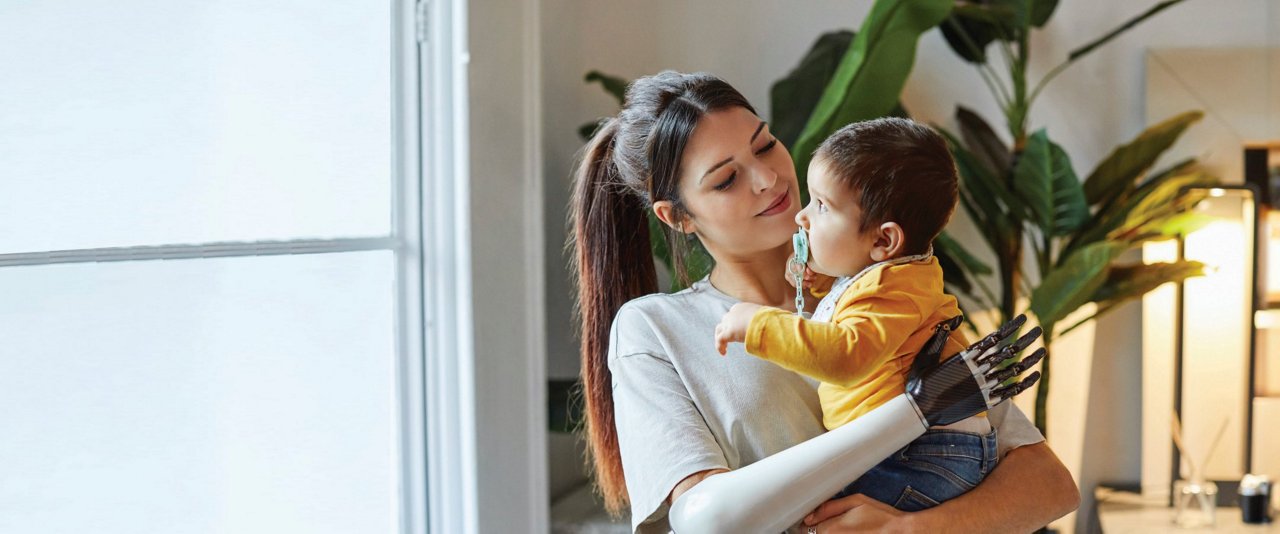 Mother with prosthetic arm holding child