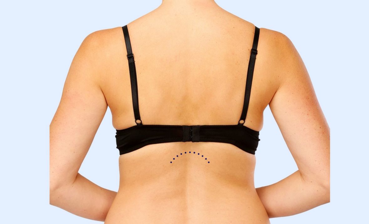 Your Bra Doesn't Fit or is Uncomfortable? Fixing Common Bra