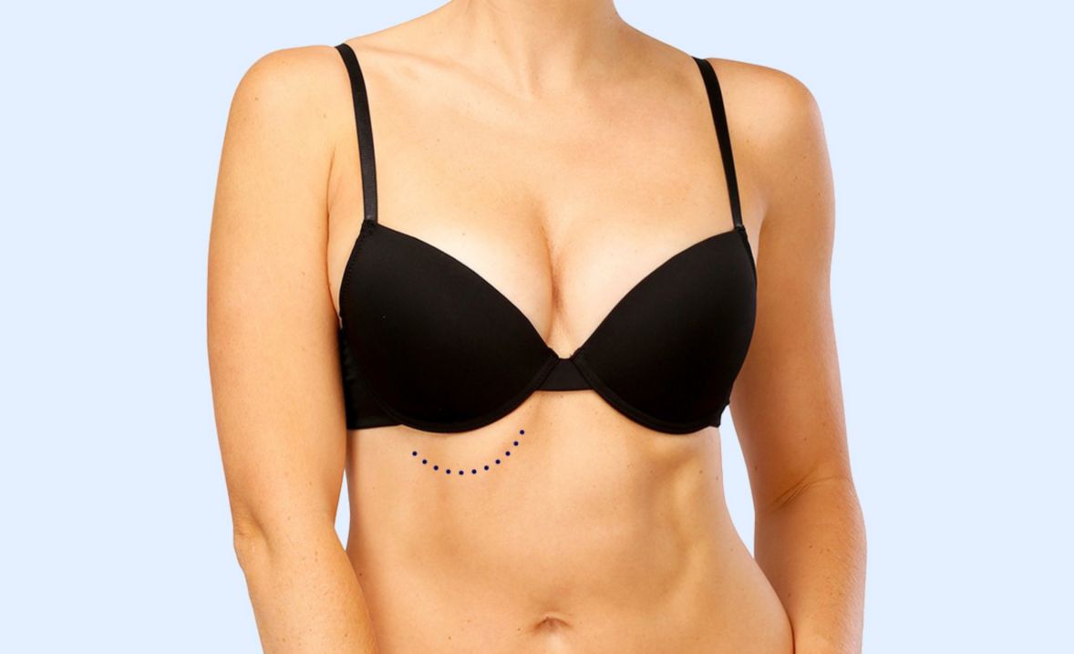 Why Does My Bra Gap In The Front? – Reasons For Your Bra Cups