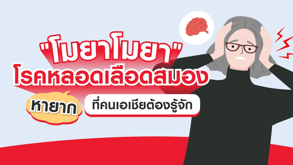 โมยาโมยา - โรคหลอดเลือดสมองหายากที่คนเอเชียต้องรู้จัก
