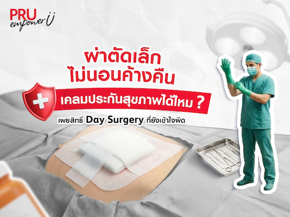 ผ่าตัดเล็ก ไม่นอนค้างคืน เคลมประกันสุขภาพได้ไหม? เผยสิทธิ์ Day Surgery ที่ยังเข้าใจผิด!