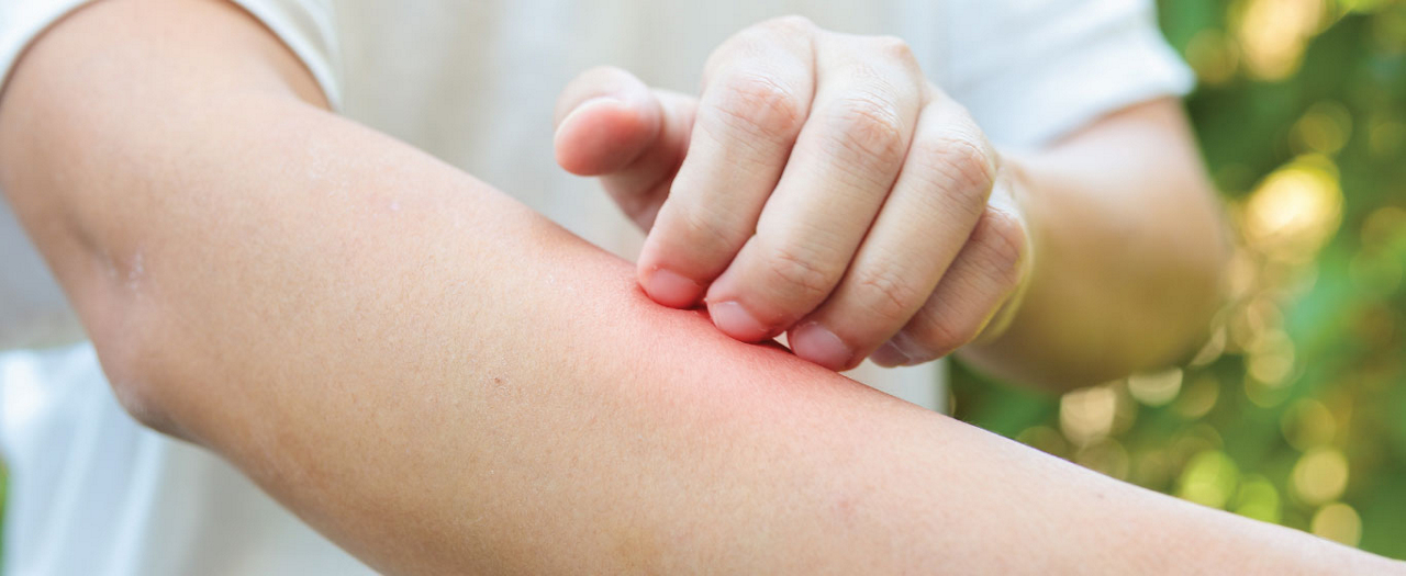 Dengue Defense: A Daily Lifestyle