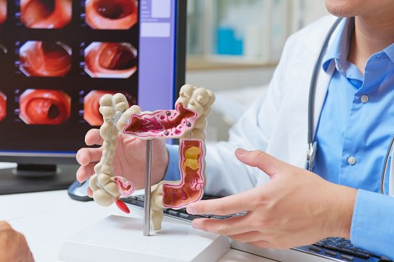 Gastrointestinal Endoscopy