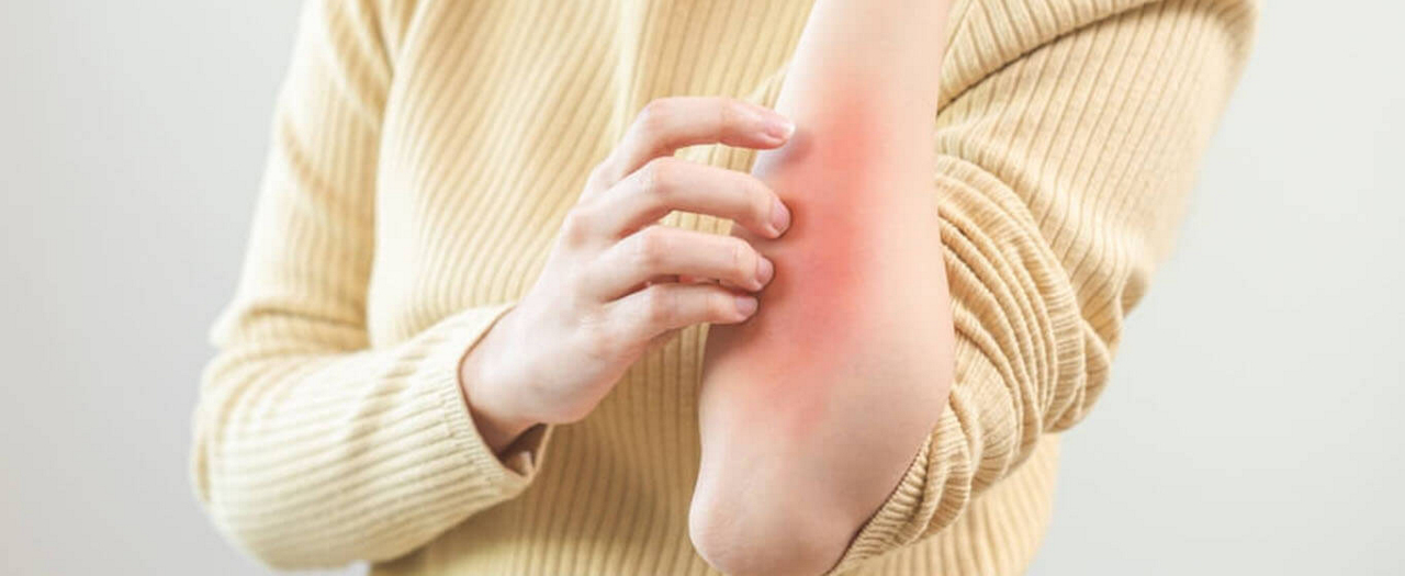 ห้ามมองข้าม! อาการผื่นคันตามตัวที่เป็นสัญญาณจากร่างกาย