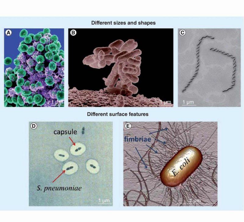 Figure 2: The complex sizes, shapes, and surface features characterizing microorganisms. (A) The spherical shape of Staphylococcus epidermidis. (B) The rod-like structure of E. coli. (C) The spiral shape of leptospires. (D) The polysaccharide capsule of S. pneumoniae avoids bacterial clearance performed by host cells, since the bacterial antigens are hidden to both immunoglobulin proteins & phagocytic cell lines, e.g. macrophages. (E) The adhesive organelles’ type 1 fimbriae allow bacteria to adhere to both host tissues & abiotic surfaces, thus starting the colonization processes, followed by biofilm formation & development.